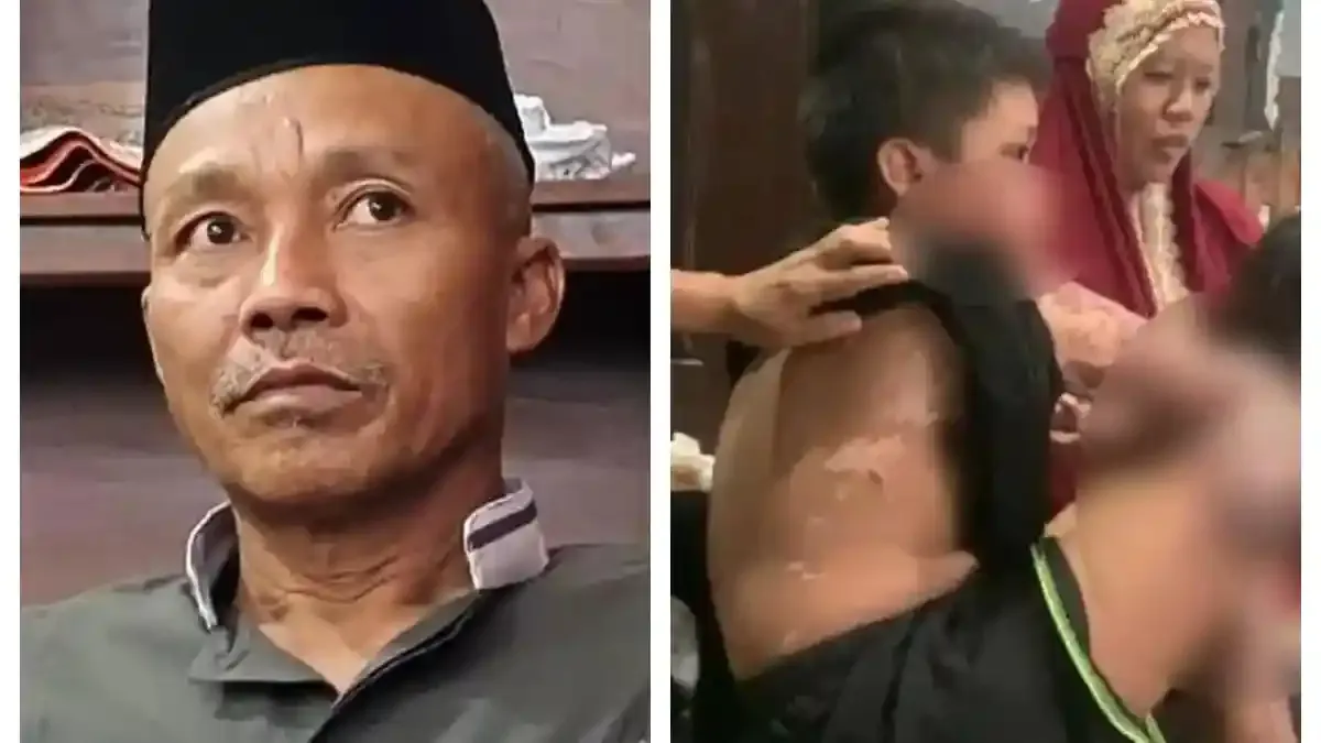 Kisah Pilu Ayah Santri Korban Tragedi: BPJS Ditolak, Harta Ludes Demi Pengobatan Anak